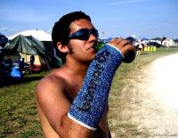 Broken Arm Bonnaroo